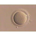 In-Vitro Fertilization Glass Pipettes (IVP1A and IVP1B)